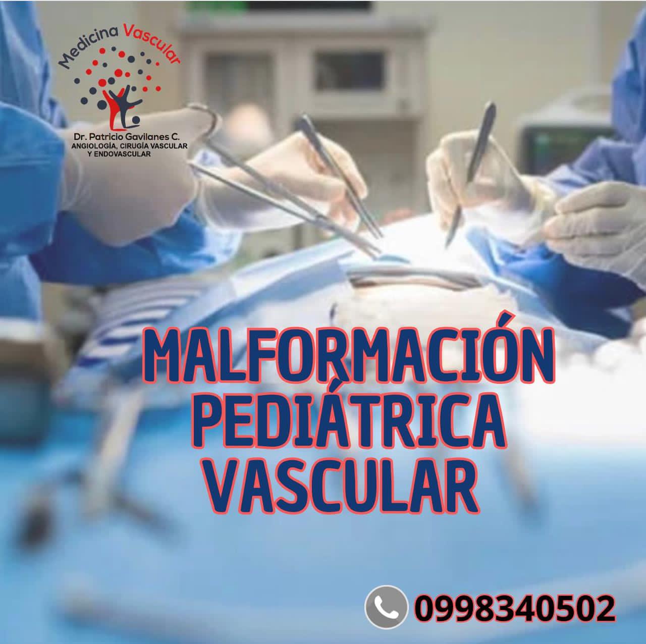 Equipo de diagnóstico vascular de alta tecnología